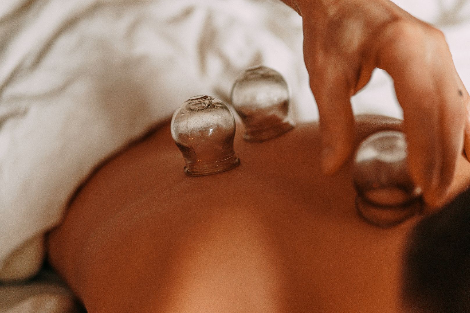 what is a cupping massage